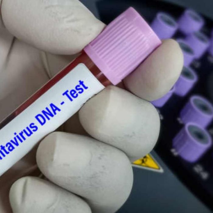 Qué es el hantavirus y cómo se transmite: claves tras el brote en el crucero MV Hondius